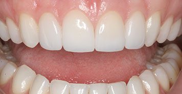 Family, Cosmetic & Implant Dentist in Lexington, KY