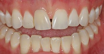 Family, Cosmetic & Implant Dentist in Lexington, KY