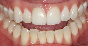 Family, Cosmetic & Implant Dentist in Lexington, KY
