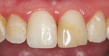 Family, Cosmetic & Implant Dentist in Lexington, KY