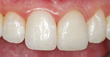 Family, Cosmetic & Implant Dentist in Lexington, KY