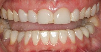 Family, Cosmetic & Implant Dentist in Lexington, KY