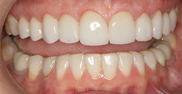 Family, Cosmetic & Implant Dentist in Lexington, KY