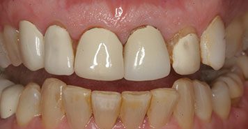 Family, Cosmetic & Implant Dentist in Lexington, KY