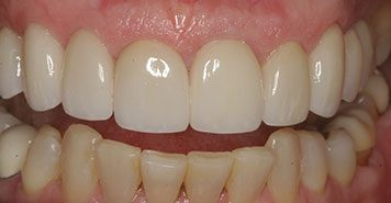 Family, Cosmetic & Implant Dentist in Lexington, KY