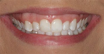 Family, Cosmetic & Implant Dentist in Lexington, KY