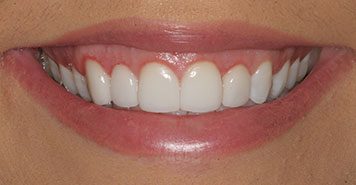 Family, Cosmetic & Implant Dentist in Lexington, KY