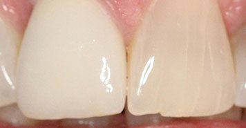 Family, Cosmetic & Implant Dentist in Lexington, KY