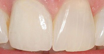 Family, Cosmetic & Implant Dentist in Lexington, KY