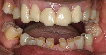 Family, Cosmetic & Implant Dentist in Lexington, KY