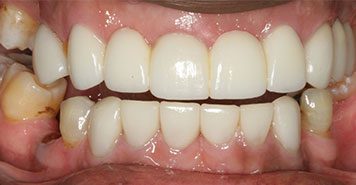Family, Cosmetic & Implant Dentist in Lexington, KY