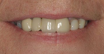 Family, Cosmetic & Implant Dentist in Lexington, KY