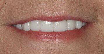 Family, Cosmetic & Implant Dentist in Lexington, KY