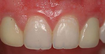 Family, Cosmetic & Implant Dentist in Lexington, KY