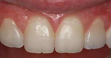 Family, Cosmetic & Implant Dentist in Lexington, KY