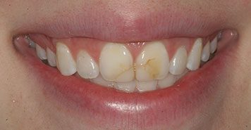 Family, Cosmetic & Implant Dentist in Lexington, KY