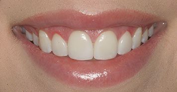 Family, Cosmetic & Implant Dentist in Lexington, KY