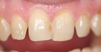 Family, Cosmetic & Implant Dentist in Lexington, KY