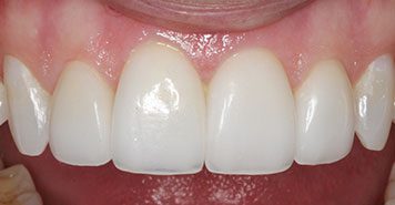 Family, Cosmetic & Implant Dentist in Lexington, KY