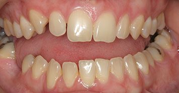 Family, Cosmetic & Implant Dentist in Lexington, KY