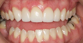 Family, Cosmetic & Implant Dentist in Lexington, KY