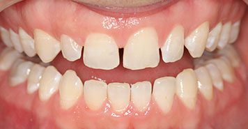 Family, Cosmetic & Implant Dentist in Lexington, KY