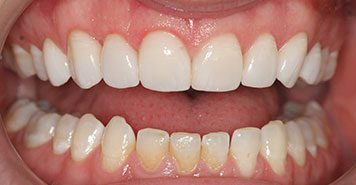 Family, Cosmetic & Implant Dentist in Lexington, KY