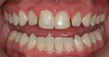 Family, Cosmetic & Implant Dentist in Lexington, KY