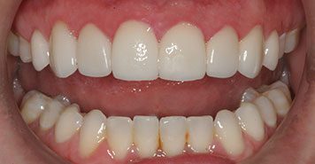 Family, Cosmetic & Implant Dentist in Lexington, KY