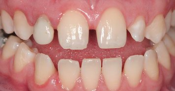 Family, Cosmetic & Implant Dentist in Lexington, KY