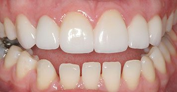 Family, Cosmetic & Implant Dentist in Lexington, KY