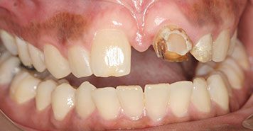 Family, Cosmetic & Implant Dentist in Lexington, KY
