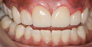 Family, Cosmetic & Implant Dentist in Lexington, KY
