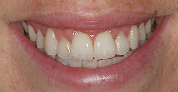Family, Cosmetic & Implant Dentist in Lexington, KY