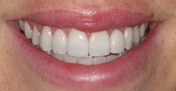 Family, Cosmetic & Implant Dentist in Lexington, KY