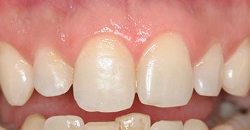Family, Cosmetic & Implant Dentist in Lexington, KY
