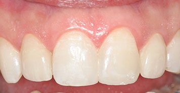 Family, Cosmetic & Implant Dentist in Lexington, KY