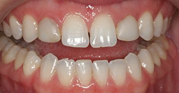 Family, Cosmetic & Implant Dentist in Lexington, KY