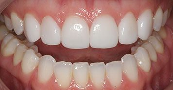 Family, Cosmetic & Implant Dentist in Lexington, KY