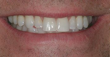 Family, Cosmetic & Implant Dentist in Lexington, KY