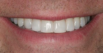 Family, Cosmetic & Implant Dentist in Lexington, KY