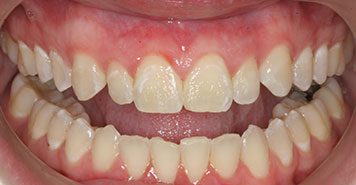 Family, Cosmetic & Implant Dentist in Lexington, KY