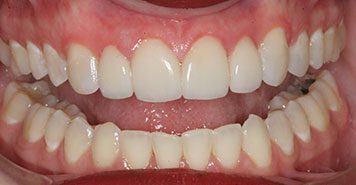 Family, Cosmetic & Implant Dentist in Lexington, KY