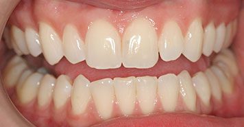 Family, Cosmetic & Implant Dentist in Lexington, KY