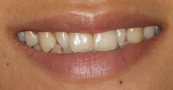 Family, Cosmetic & Implant Dentist in Lexington, KY
