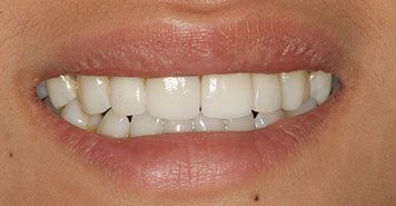 Family, Cosmetic & Implant Dentist in Lexington, KY