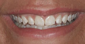 Family, Cosmetic & Implant Dentist in Lexington, KY