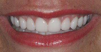 Family, Cosmetic & Implant Dentist in Lexington, KY