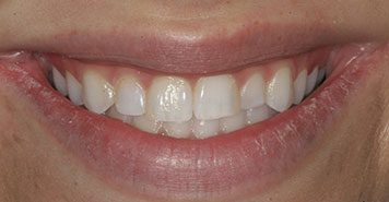 Family, Cosmetic & Implant Dentist in Lexington, KY
