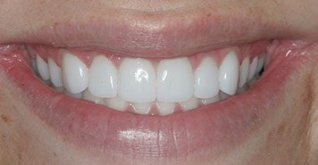 Family, Cosmetic & Implant Dentist in Lexington, KY